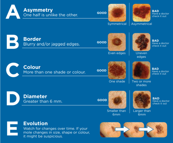 Blog Post Image
